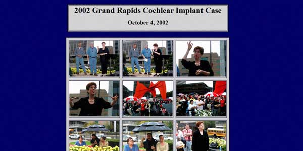 Grand Rapids Cochlear Implant Case